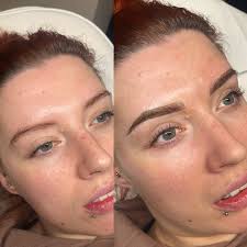 Combination brow before and after 🫶🏼🤎 Our aim was to create more shape ,  definition and symmetry. These will heal up to 30/40% lighter to a natural  tint !🤎 Pigments used : @