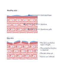 Image result for Neurodermatitis