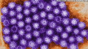 You can get norovirus by: Noroviren