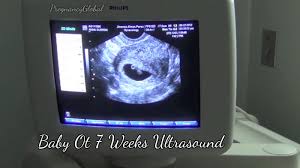 Pin On Pregnancy Global
