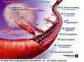 Or changes in your sense of taste. Avastin Injection