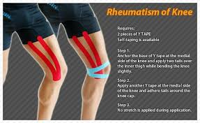 The Exact Cause Of Ra Is Unknown But There Are Several Theories Some People May Be More Likely To Devel Kinesiology Taping Kinesio Taping Knee Kinesio Taping