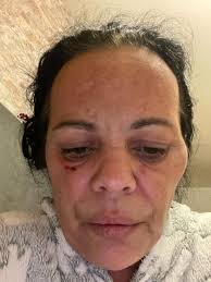 Racist thug assaults mum and child outside Glasgow Stormzy gig