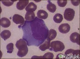 Típicamente ocurre en adolescentes, pero se puede. Mononucleosis Infecciosa 3 Medlineplus Enciclopedia Medica Illustracion