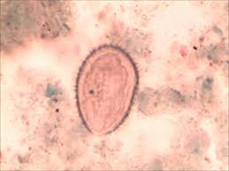 Image result for Balantoides Coli