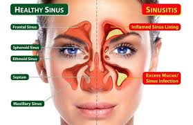 Dalam rongga hidung terdapat konka yang banyak mengandung kapiler darah, fungsinya adalahh. Vitamin Shaklee Untuk Resdung Eina Md Ali Pengedar Shaklee Kedai Nutrisi Usj Subang Jaya