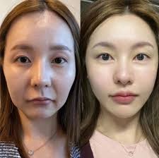 HK One piece 海賊王tcg 交流買賣區| 虎紋都平整曬，勁過打針| Facebook