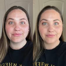 Amazing facial products for clear skin