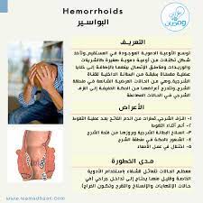 البواسير معانة حقيقية لكثير من الناس اعرف أكثر عنها المصدر med scape com 2014 محمد خيري wamadha health and beauty hemorrhoids health