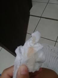 Corrimento Amarelado Rosado Minha Primeira Gravidez Babycenter