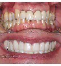 Envy is copyright envy development team (getenvy.com) previously developed as peerproject (peerproject.org, peerproject.sourceforge.net) originally derived from shareaza, with appreciation. Envy Smile Dental Spa Inicio Facebook