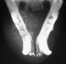Sores, lumps, a strange odor, bleeding, or a change in gum color can be a sign of oral cat cancer, particularly in older cats. Squamous Cell Carcinoma In Pets Long Beach Animal Hospital