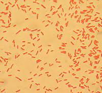 For bacteria to take in a plasmid, they must first be made competent to take up dna, which won't normally pass through a bacterial cell's this is done by creating small holes in the bacterial cells by suspending them in a solution with a high concentration of calcium. Pathogenic Escherichia Coli Wikipedia