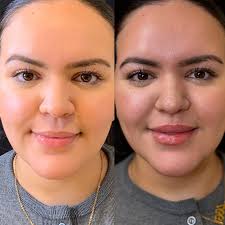 Aestheics nurse practitioner