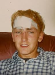 I almost died 29 years ago due to a horse kicking me in the head.i was  hoping anyone could make this old picture funny or interesting please 🙏