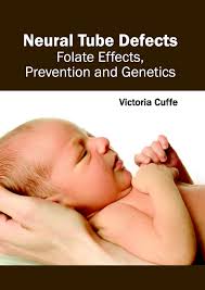 ML Books International