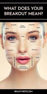 Acne Face Map Meaning Of Pimple Location Best Acne Treatments Guide Face Mapping Acne Face Acne Face Mapping