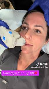 Looking for a lip lift without the needles? 👄, ✨ Ultherapy uses ultrasound  energy to tighten and lift the skin — giving your lips that naturally  elevated look you’ll love!, 📞 Book your FREE ...