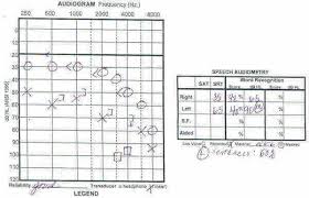 Understanding Your Audiogram