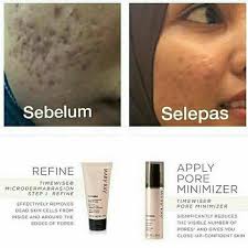 Mary kay clinical solutions™ retinol 0.5 set. Set Merawat Parut Berlubang Berlekuk Microdermabrasion Set Shopee Malaysia