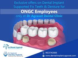 The following programs are mainly based on volunteer dentists and labs, catering to those who need dental work most. Teeth In A Day Cost Teethwalls