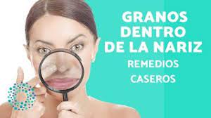 Como Quitar Un Grano Dentro De La Nariz Remedios Naturales Youtube