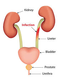 Having uti may cause you to urinate more frequently. Can I Have Sex With A Uti Quora