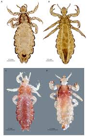 Vinegar is a common home remedy for head lice, but some people mistakenly think it will kill adult lice and their eggs, which are called nits. Adult Body Louse And Head Lice A Ventral View Of Slide Mounted Female Download Scientific Diagram