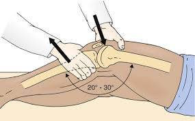 Image result for Lachman Test