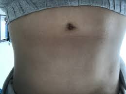 Es ist nicht schwieriger am bauch abzunehmen als an jedem anderen teil des körpers. Speck Am Bauch Verlieren Mit 12 13 Jahren Abnehmen
