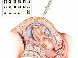 Femurlange Tabelle Und Grosse Des Babys 9monate De