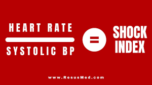 Image result for Shock Index