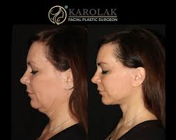 Dr. Mark Karolak added a new photo — in...