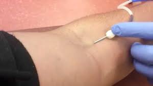 Bible verses about hurt feelings. Donating Blood Needle Insertion Youtube