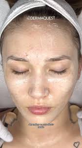 Want an instant lift for your skin? Introducing our Firming Enzyme  Treatment, a DermaQuest Partner Treatment Room Exclusive 🧖‍♀️💘🫧, Our  DermaQuest Ambassador Nuala @glowskincareandwax performs a ...