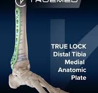 TRUE LOCK Superior Distal Clavicle Anatomic Plate position ...