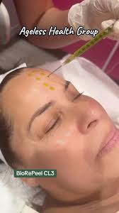 Qué es BioRePeel? 🔥, Un tratamiento exfoliante innovador que disuelve los  enlaces entre las células y elimina cuidadosamente la capa superior de la  piel revelando la capa suave y brillante que se ...