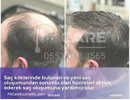 fitcare hair sac ve sakal bakim losyonu satis ve bayilik home facebook