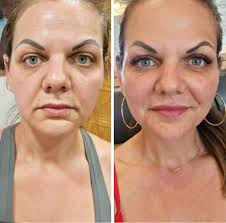 Cast Your Vote for the Top 100 Best Aesthetic Injectors in the USA 2026