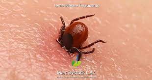 Lyme Disease Treatment Nyc By Marc Bystock L Ac