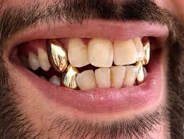 Check spelling or type a new query. Permanent Gold Teeth Near Me Teethwalls