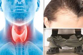 Radiation exposure children who get radiation therapy for some cancers, such as lymphoma, have a higher chance of getting thyroid cancer. Thyroid Cancer Warning Why You Should Never Ignore A Sore Throat Express Co Uk