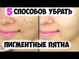 маски от пятен после прыщей на лице в домашних условиях Mne 57 Let Ya Primenyayu Recept 7 Ezhednevno I Vse Pigmentnye Ischezli Poyavlenie Pigmentnyh Pyaten Vyzvano Vysokim Proizvodstv Lechenie Pryshej Shramy Ot Pryshej Lico