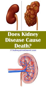 Kidney Disease Diet Drinks Kidney Disease Chronic Kidney Disease Kidney Infection