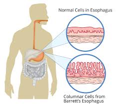 Image result for esophagus