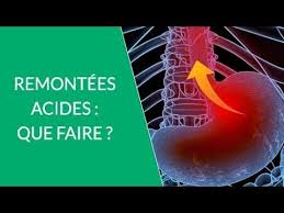 Pour les remontées acides bien désagréables j'avais pour remède du gaviscon toujours sur moi, ça m'a beaucoup aidé. Remontees Acides Que Faire Pour Les Eviter Youtube
