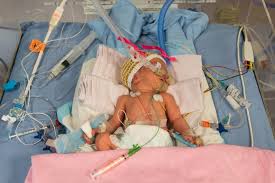 At 32 weeks pregnant, you only have about eight weeks left to go. Premature Baby 32 Weeks Newborn Baby