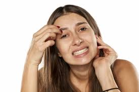 Eyebrow hair loss is common, but the causes differ from person to person. Scales On The Eyebrows Eyebrows Itchy And Falling Out Causes And Tips For Treatment Inebra