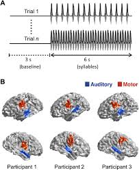 Check spelling or type a new query. The Coupling Between Auditory And Motor Cortices Is Rate Restricted Evidence For An Intrinsic Speech Motor Rhythm Science Advances