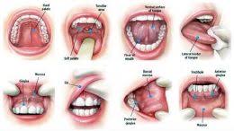 Image result for gum cancer symptoms